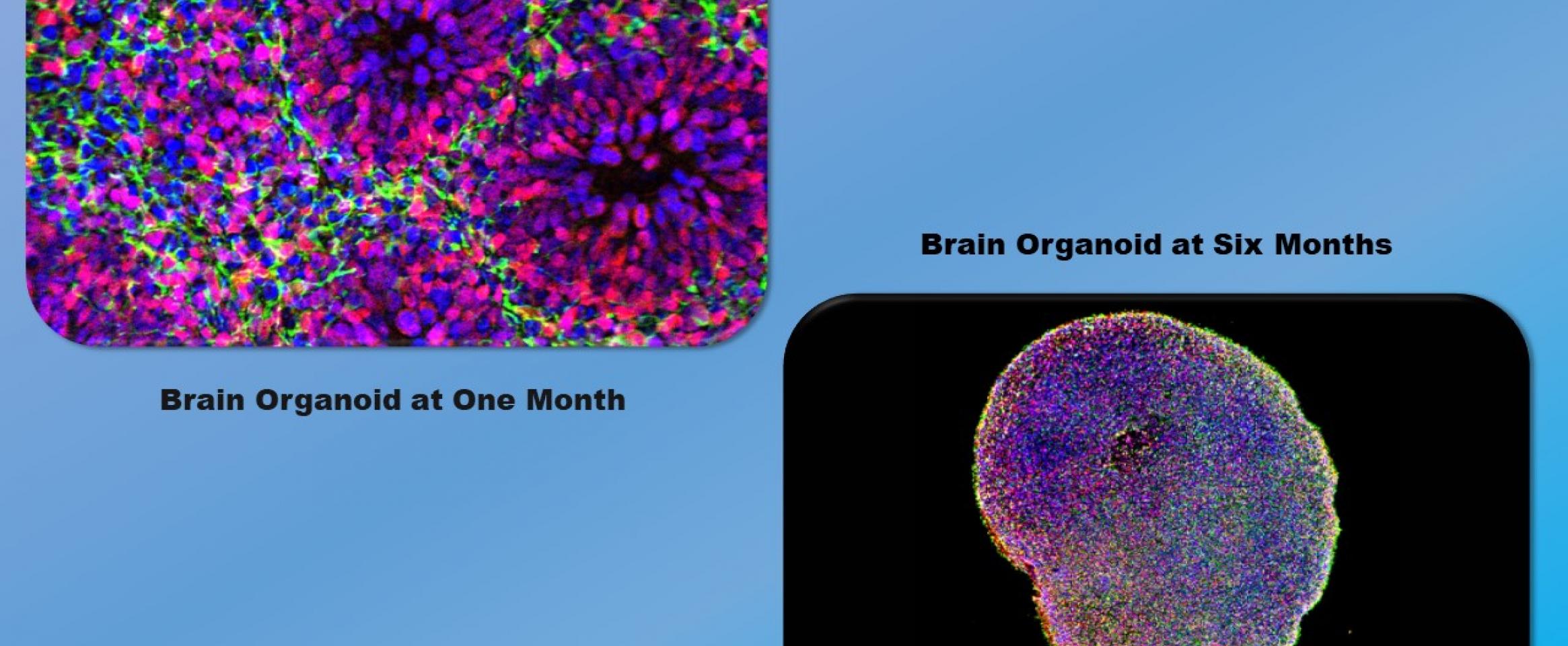 Developing brain organoid