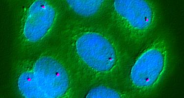 Photo: Mapping the position of genes in the cell nucleus