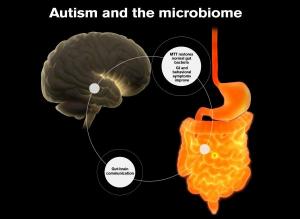 A graphic illustration of microbiota transfer therapy.