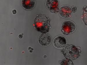 Sheep blastocysts with human stem cells