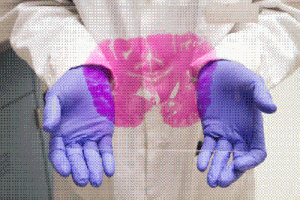 A researcher holding a pink-stained section of human brain