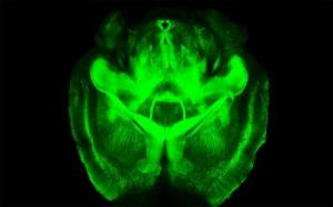 CLARITY visualization of an intact mouse brain. Credit: Kwanghun Chung and Karl Deisseroth.