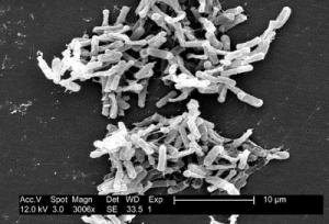 Clostridium difficile. Credit: CDC/ Lois S. Wiggs, 2004.