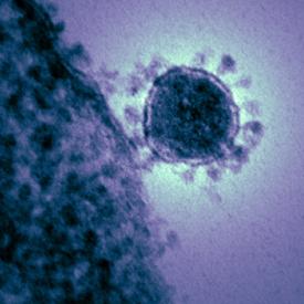 A colorized electron micrograph of the new coronavirus HCoV-EMC. Credit: NIAID/RML Beth Fischer