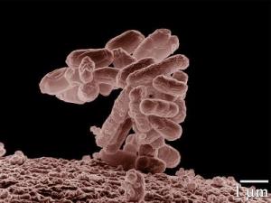 E. coli, magnified 10X