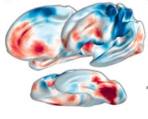 Brain regions that correlate positively (red) and negatively (blue) with journal impact factor. Credit: Behrens et al, TICS 2012
