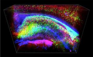 Neurons in a mouse hippocampus visualized using CLARITY and fluorescent labelling. Credit: Kwanghun Chung & Karl Deisseroth