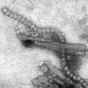 Electron micrograph of the H7N9 influenza virus