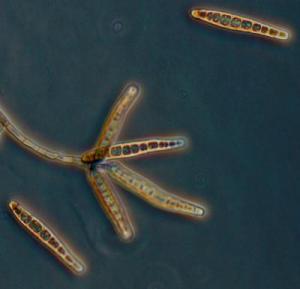 The fungus Exserohilum rostratum, suspected of causing the current deadly outbreak of meningitis. Credit: CDC