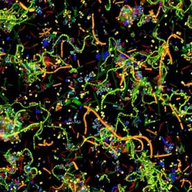 Spectral fluorescence image of 15 kinds of microorganisms from the human mouth.