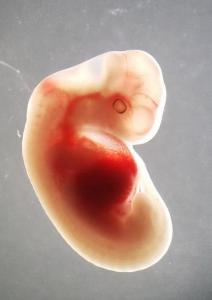 Sheep embryo with human cells