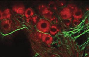 Inner-ear nerve fibers and cells 