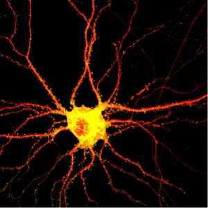 Yeast may help scientists study diseases that destroy brain cells such as this one. Credit: MIT 